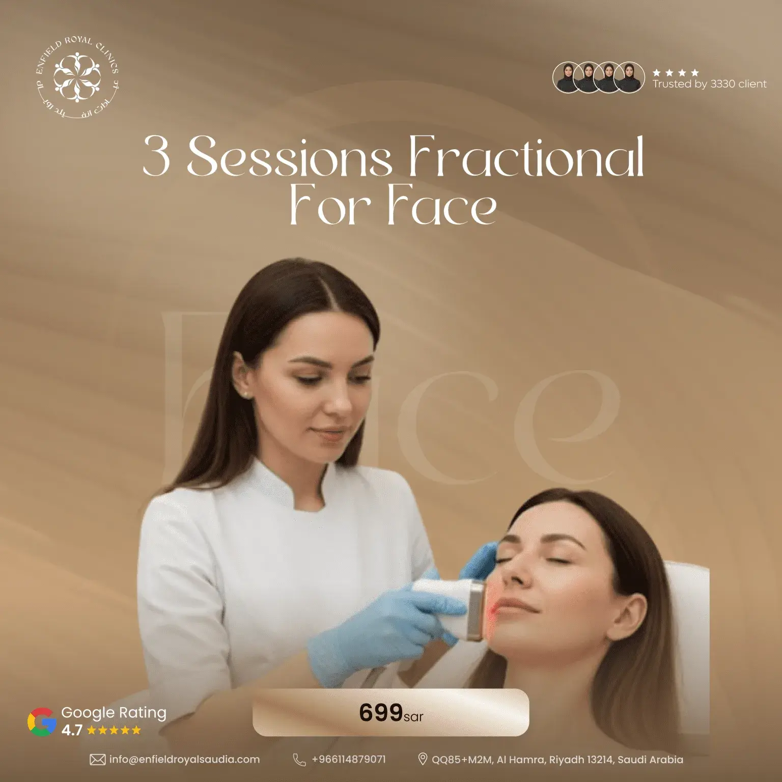 3-session fractional for face