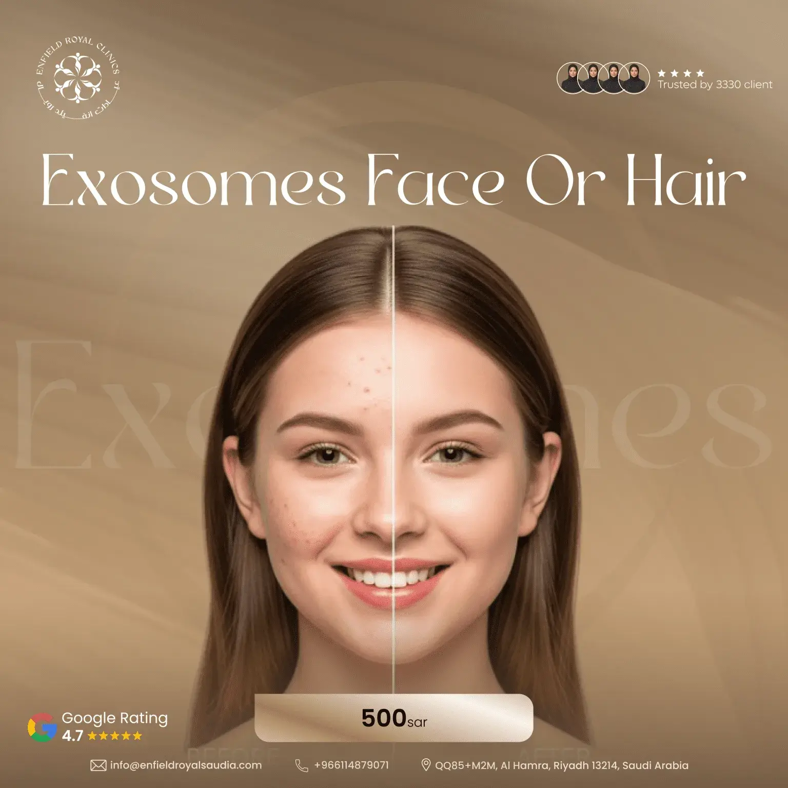 Exosomes face or Hair