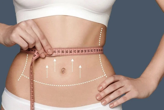 Liposuction in Riyadh 6 Lipoabdominoplasty in Riyadh