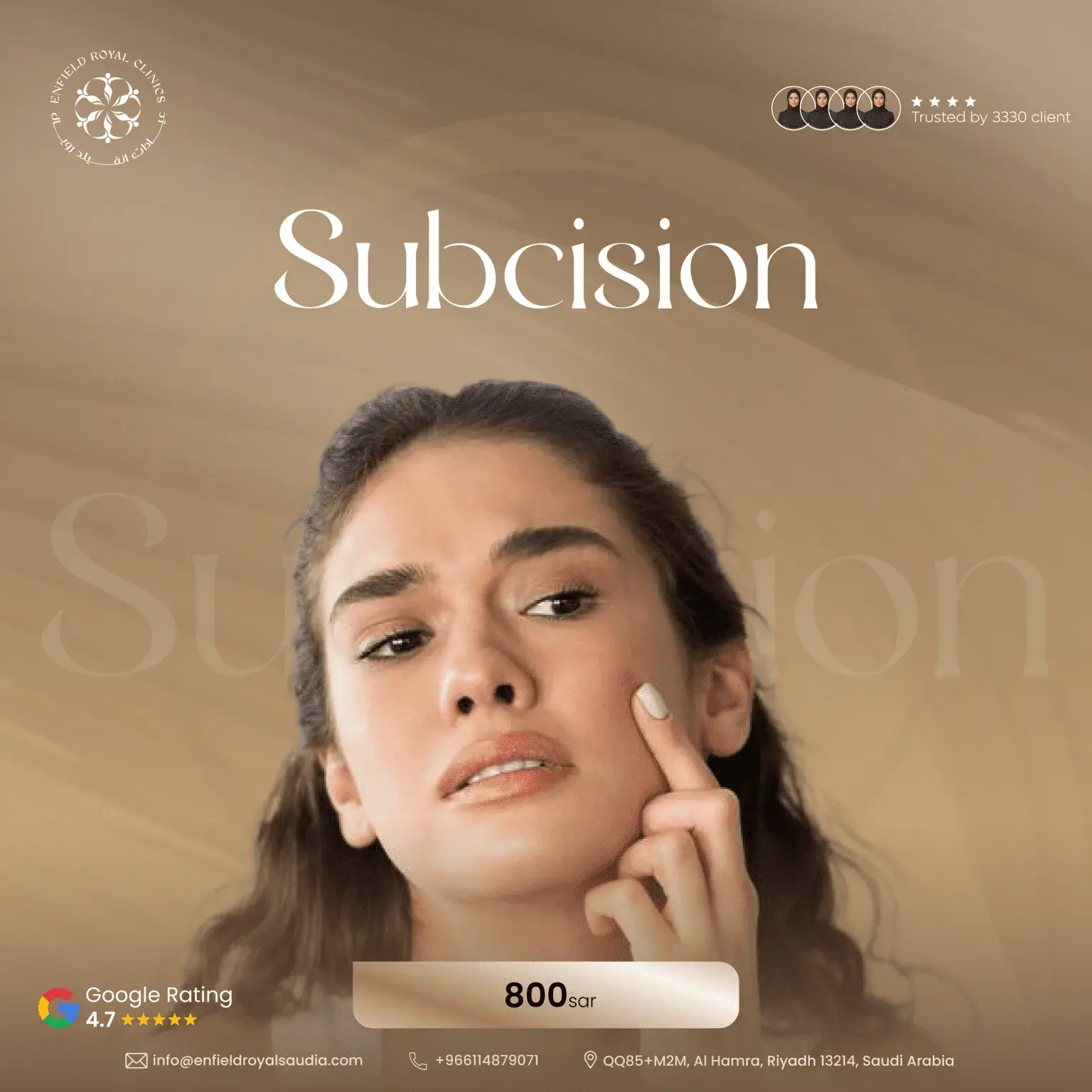 Subcision