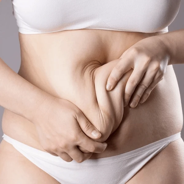 Liposuction in Riyadh 7 Tummy Tuck in Riyadh