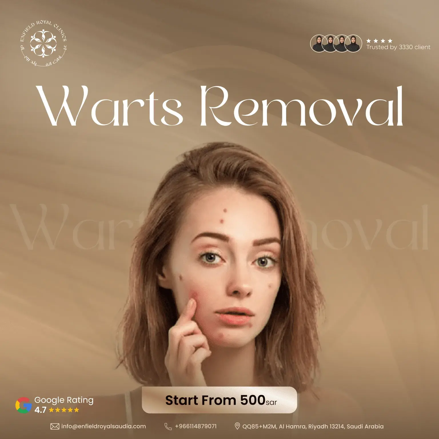 Warts Removal